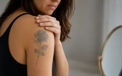 I Have an Old Tattoo I Hate What Are My Options?